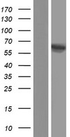 IMPDH1 Human Over-expression Lysate