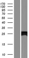 ECSIT Human Over-expression Lysate