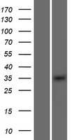 OSR2 Human Over-expression Lysate