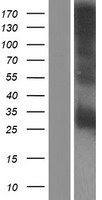 CRISP2 Human Over-expression Lysate