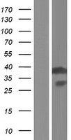 EMAP II (AIMP1) Human Over-expression Lysate
