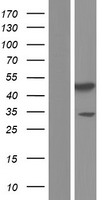 PDK3 Human Over-expression Lysate