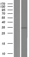 WDR58 (THOC6) Human Over-expression Lysate