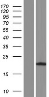 DUSP19 Human Over-expression Lysate
