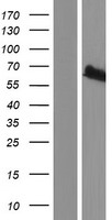 RNF156 (MGRN1) Human Over-expression Lysate