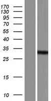 RNASEH2B Human Over-expression Lysate