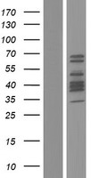 DACH2 Human Over-expression Lysate