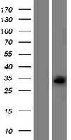 ECHDC1 Human Over-expression Lysate