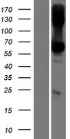 TMEM151B Human Over-expression Lysate