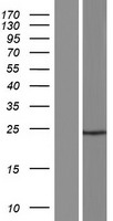 CFAP97D1 Human Over-expression Lysate