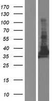 SEC13L1 (SEC13) Human Over-expression Lysate
