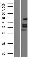 EGR2 Human Over-expression Lysate
