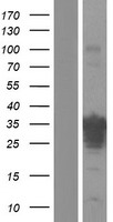 R3HCC1 Human Over-expression Lysate