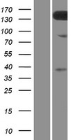 TMEM132C Human Over-expression Lysate