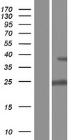 UCK (UCK1) Human Over-expression Lysate