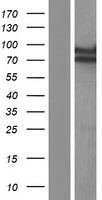 SGT1 (ECD) Human Over-expression Lysate