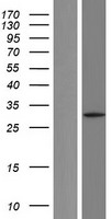 LDHA Human Over-expression Lysate