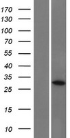 CCDC152 Human Over-expression Lysate