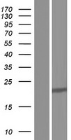 DDAH1 Human Over-expression Lysate