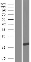 SAP30L Human Over-expression Lysate
