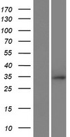 LOC285498 (RNF212) Human Over-expression Lysate