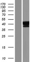 SUGT1 Human Over-expression Lysate