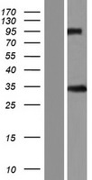 Claudin 5 (CLDN5) Human Over-expression Lysate