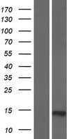 C19orf69 (ERICH4) Human Over-expression Lysate