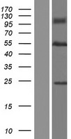 ABLIM2 Human Over-expression Lysate