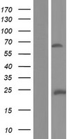 ABLIM2 Human Over-expression Lysate