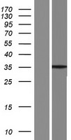 SYCE1L Human Over-expression Lysate