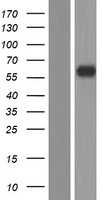 DPEP3 Human Over-expression Lysate