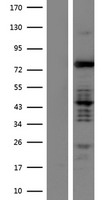 MARK3 Human Over-expression Lysate