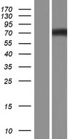 Nephronophthisis (NPHP1) Human Over-expression Lysate