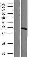 ETFA Human Over-expression Lysate