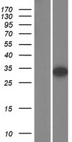 AUTS2 Human Over-expression Lysate
