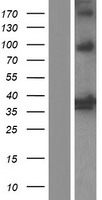 Heme oxygenase 2 (HMOX2) Human Over-expression Lysate