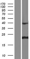 CNBP Human Over-expression Lysate