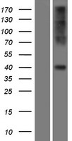 CCR2 Human Over-expression Lysate