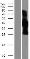 TACC1 Human Over-expression Lysate
