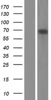 p63 (TP63) Human Over-expression Lysate