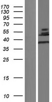 CLIC5 Human Over-expression Lysate