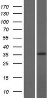 C17orf76 (LRRC75A) Human Over-expression Lysate