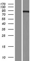 ECE1 Human Over-expression Lysate