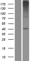 SLC35E2B Human Over-expression Lysate