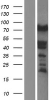 Synaptopodin (SYNPO) Human Over-expression Lysate