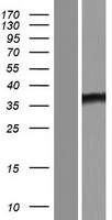ANKRD58 (SOWAHD) Human Over-expression Lysate