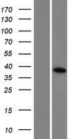CCDC160 Human Over-expression Lysate