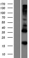 ADM5 Human Over-expression Lysate
