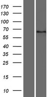 Dystrotelin (DYTN) Human Over-expression Lysate